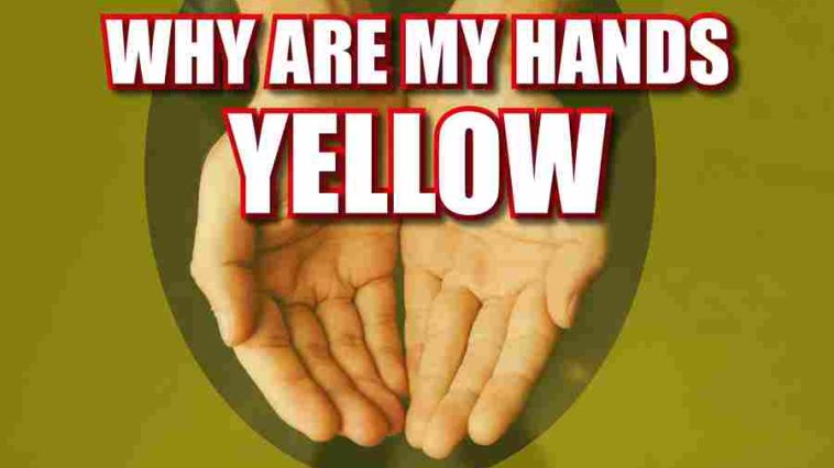 Why Are My Hands Yellow